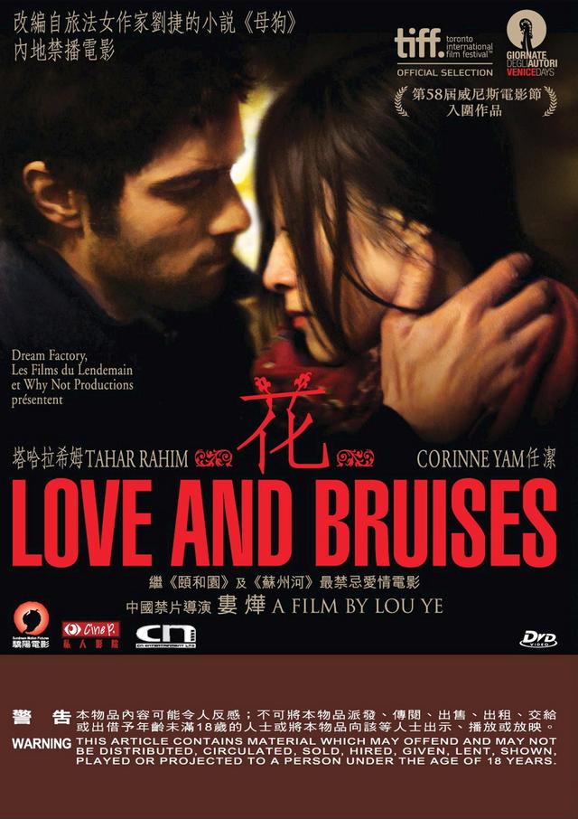 Love And Bruises